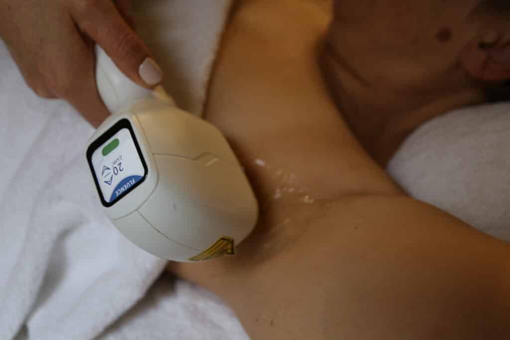 Epilation laser hochfelden
